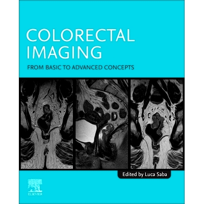 预订 Colorectal Imaging: From Basic to Advanced Concepts 结直肠成像：从基础到高级概念: 9780443290480