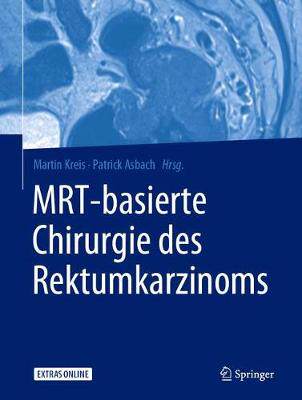 预订 MRT-basierte Chirurgie des Rektumkarzinoms