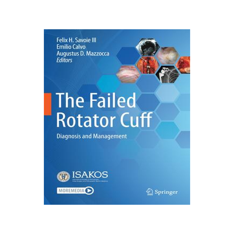 [预订]The Failed Rotator Cuff 9783030794804