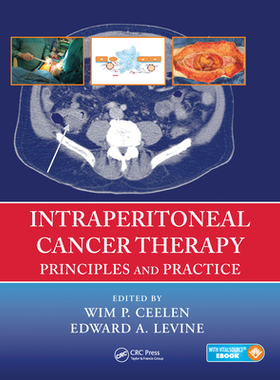 【预订】Intraperitoneal Cancer Therapy