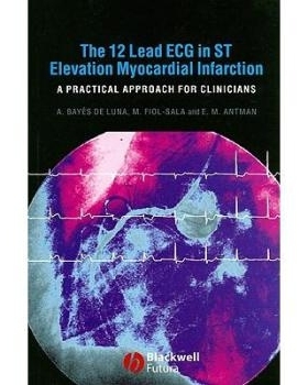 预订 12-Lead Ecg In St Elevation Myocardial Infarction: A Practical Approcah For Clinicians ST段抬高心肌梗塞的12 引入心