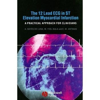 预订 12-Lead Ecg In St Elevation Myocardial Infarction: A Practical Approcah For Clinicians ST段抬高心肌梗塞的12 引入心