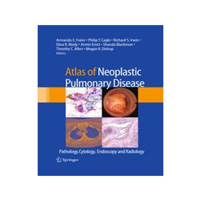 预订 Atlas of Neoplastic Pulmonary Disease