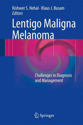 【预订】Lentigo Maligna Melanoma