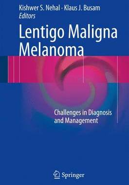 【预订】Lentigo Maligna Melanoma