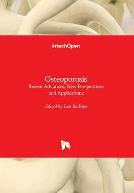[预订]Osteoporosis - Recent Advances, New Perspectives and Applications 9781839692369