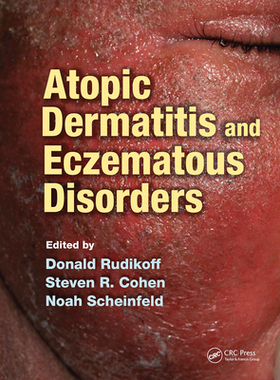 【预订】Atopic Dermatitis and Eczematous Disorders
