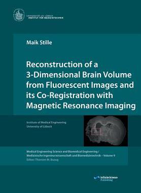 [预订]Reconstruction of a 3-Dimensional Brain Volume from Fluorescent Images and Its Co-Registration with  9783945954102