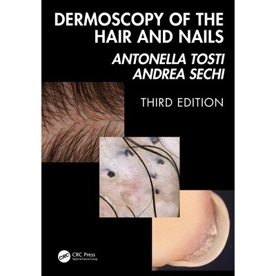 预订 Dermoscopy of the Hair and Nails 3e 毛发和指甲皮肤镜检查 3e 9781041020028