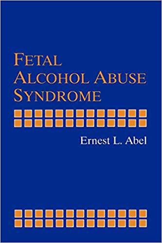 美国库房发货,通常付款后5-8周到货!