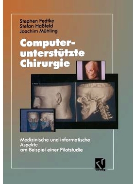 预订 Computerunterstützte Chirurgie: Medizinische und informatische Aspekte am Beispiel einer Pilotstudie: 978366305238
