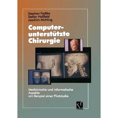 预订 Computerunterstützte Chirurgie: Medizinische und informatische Aspekte am Beispiel einer Pilotstudie: 978366305238