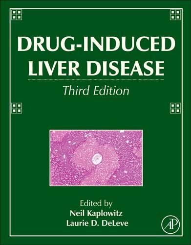 【预订】drug-induced liver disease