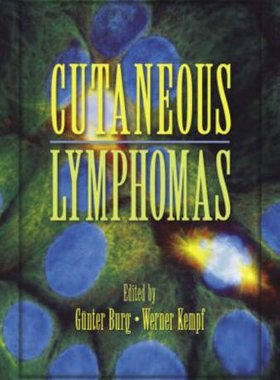【预订】Cutaneous Lymphomas