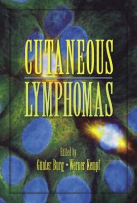 【预订】Cutaneous Lymphomas