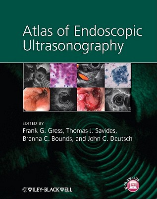 【预订】Atlas Of Endoscopic Ultrasonography + Dvd 9781405157216