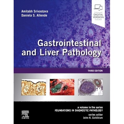 预订 Gastrointestinal and Liver Pathology A Volume in the Series: Foundations in Diagnostic Pathology 胃肠和肝脏病理学: