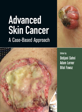 【预订】Advanced Skin Cancer 9780367134716