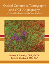 【预订】Optical Coherence Tomography and Oct Angiography: Clinical Reference and Case Studies