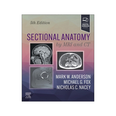 预订 Sectional Anatomy by MRI and CT
