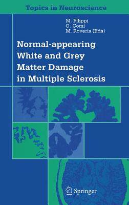 【预订】Normal-appearing White and Grey Matter Damage in Multiple Sclerosis