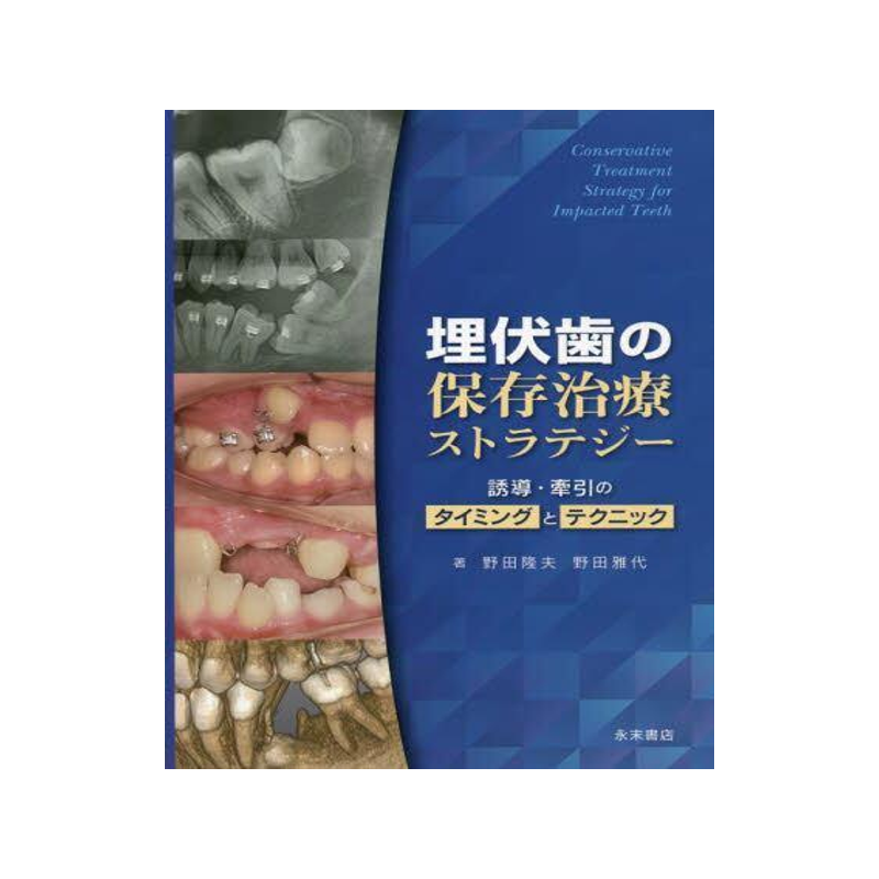 [预订]埋伏歯の保存治療ストラテジー 9784816013980