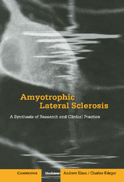 【预订】Amyotrophic Lateral Sclerosis