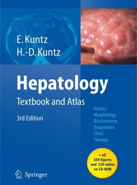 【预订】Hepatology