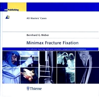 预订 Minimax Fracture Fixation: AO Masters’ Cases 极大极小的骨折固定: 9783131392718
