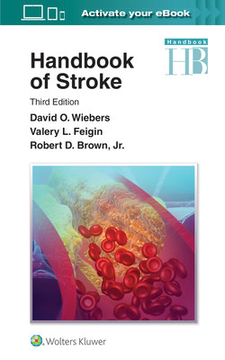 【预订】Handbook of Stroke