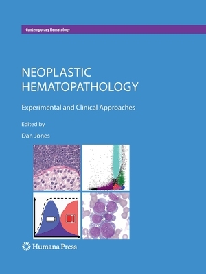 【预订】Neoplastic Hematopathology