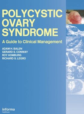 【预订】Polycystic Ovary Syndrome