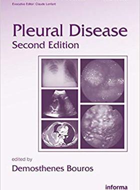 【预售】Pleural Disease, Second Edition