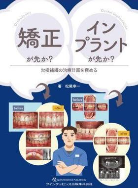 [预订]矯正が先か?インプラントが先か? 欠損補綴の治療計画を極める 9784781209623