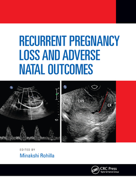 【预订】Recurrent Pregnancy Loss and Adverse Natal Outcomes 9781032173481