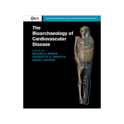 [预订]The Bioarchaeology of Cardiovascular Disease