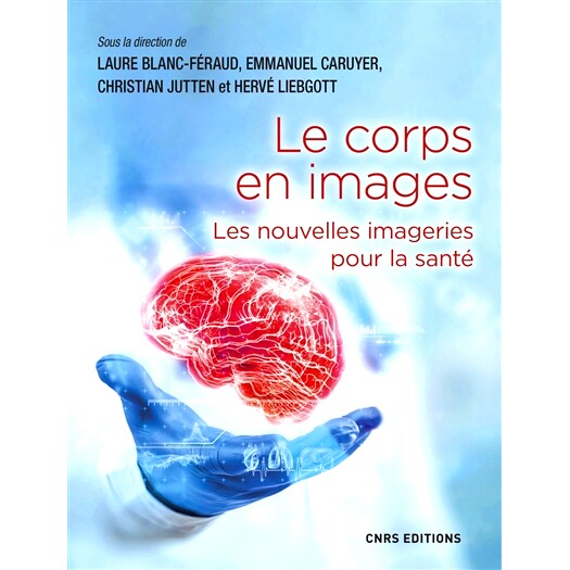 预订 Le corps en images : les nouvelles imageries pour la santé 图像中的身体：健康的新图像: 9782271143280
