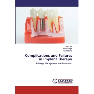 预订 Complications and Failures in Implant Therapy：Etiology, Management and Prevention: Etiology, Management and Preven