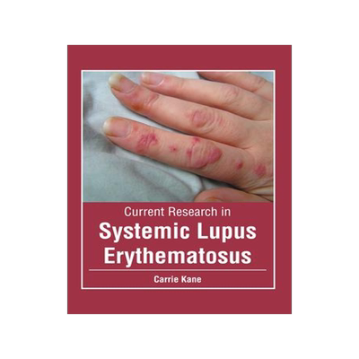 [预订]Current Research in Systemic Lupus Erythematosus 9781632429162