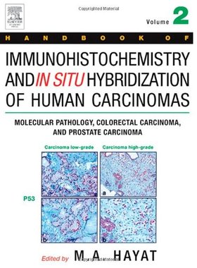 【预订】Handbook of Immunohistochemistry and in Situ Hybridization of Human Carcinomas