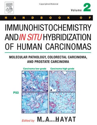 【预订】Handbook of Immunohistochemistry and in Situ Hybridization of Human Carcinomas