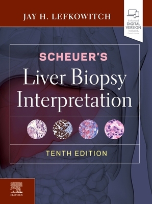 【预订】Scheuer’s Liver Biopsy Interpretation