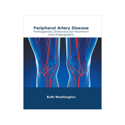 [预订]Peripheral Artery Disease: Pathogenesis, Endovascular Treatment and Angiography 9781632429186