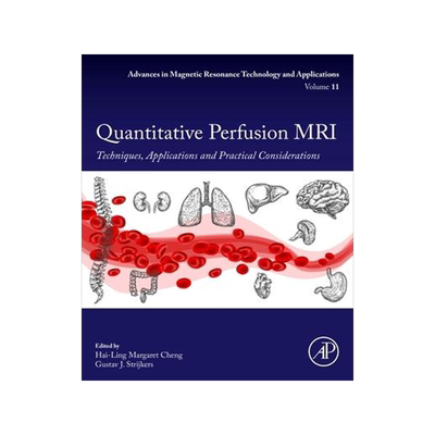 [预订]Quantitative Perfusion MRI 9780323952095