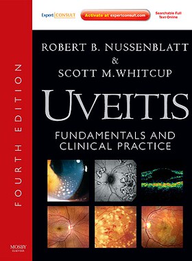 【预订】Uveitis