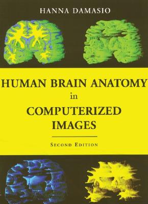 【预售】Human Brain Anatomy in Computerized Images