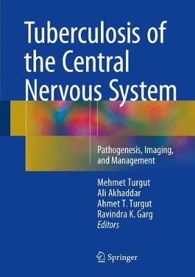【预订】Tuberculosis of the Central Nervous System