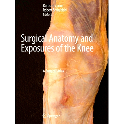 预订 Surgical Anatomy and Exposures of the Knee: A Surgical Atlas 膝关节的外科解剖学与暴露：手术图谱: 9783031476631