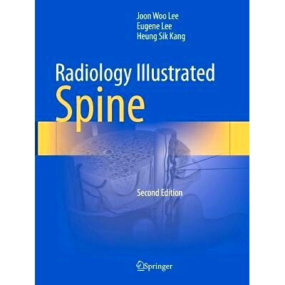 预订 Radiology Illustrated: Spine 放射学图解:脊柱 第2版: 9789819966141