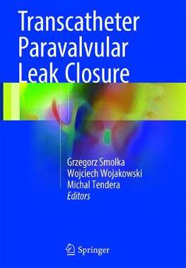 预订 Transcatheter Paravalvular Leak Closure